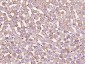 VDAC1 Recombinant Rabbit mAb, Mitochondrial Loading Control